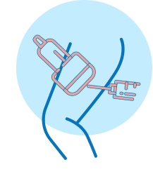 microfoam ablation treatment