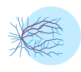 angiography