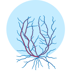 angiography in texas