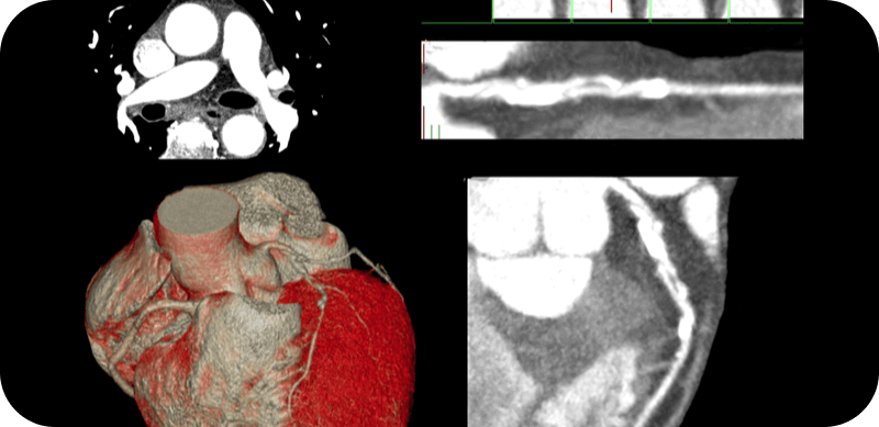 3d image of heart